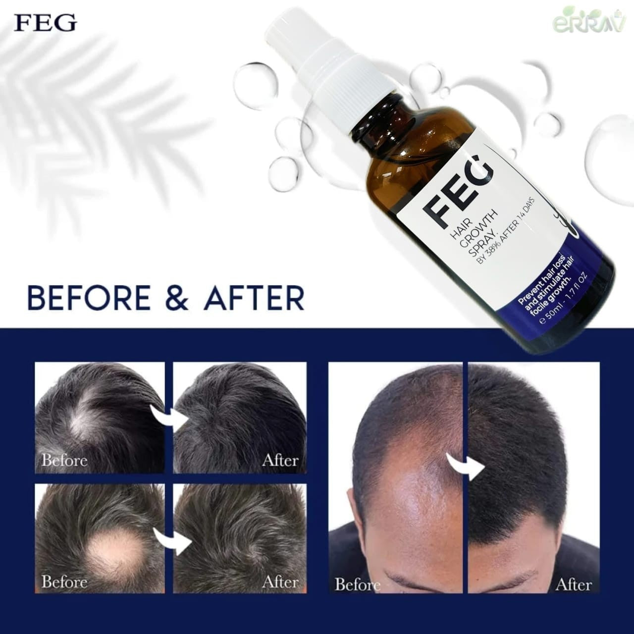 FEG Hair Growth Spray